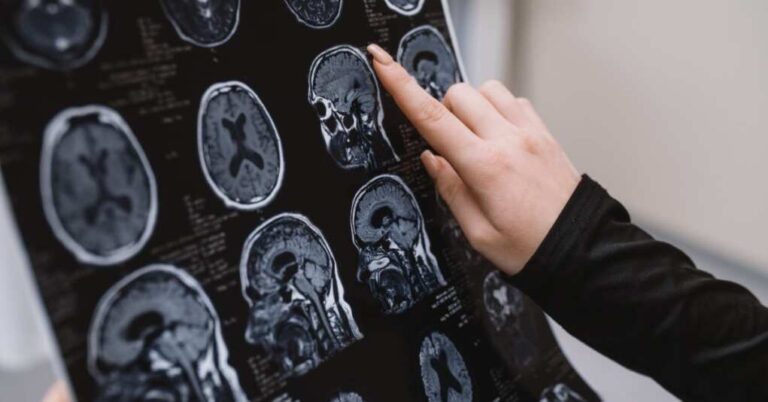 One of the Major Scientific Theories About Alzheimer’s Was Just Proven to be Fake One of the Major Scientific Theories About Alzheimer’s Was Just Proven to be Fake